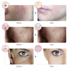 Rechargeable 7-Colour LED Facial Mask
