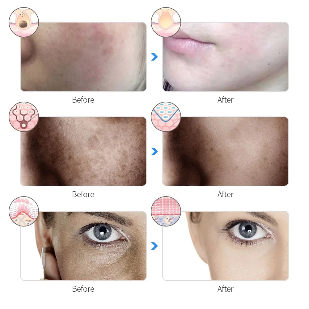 Rechargeable 7-Colour LED Facial Mask