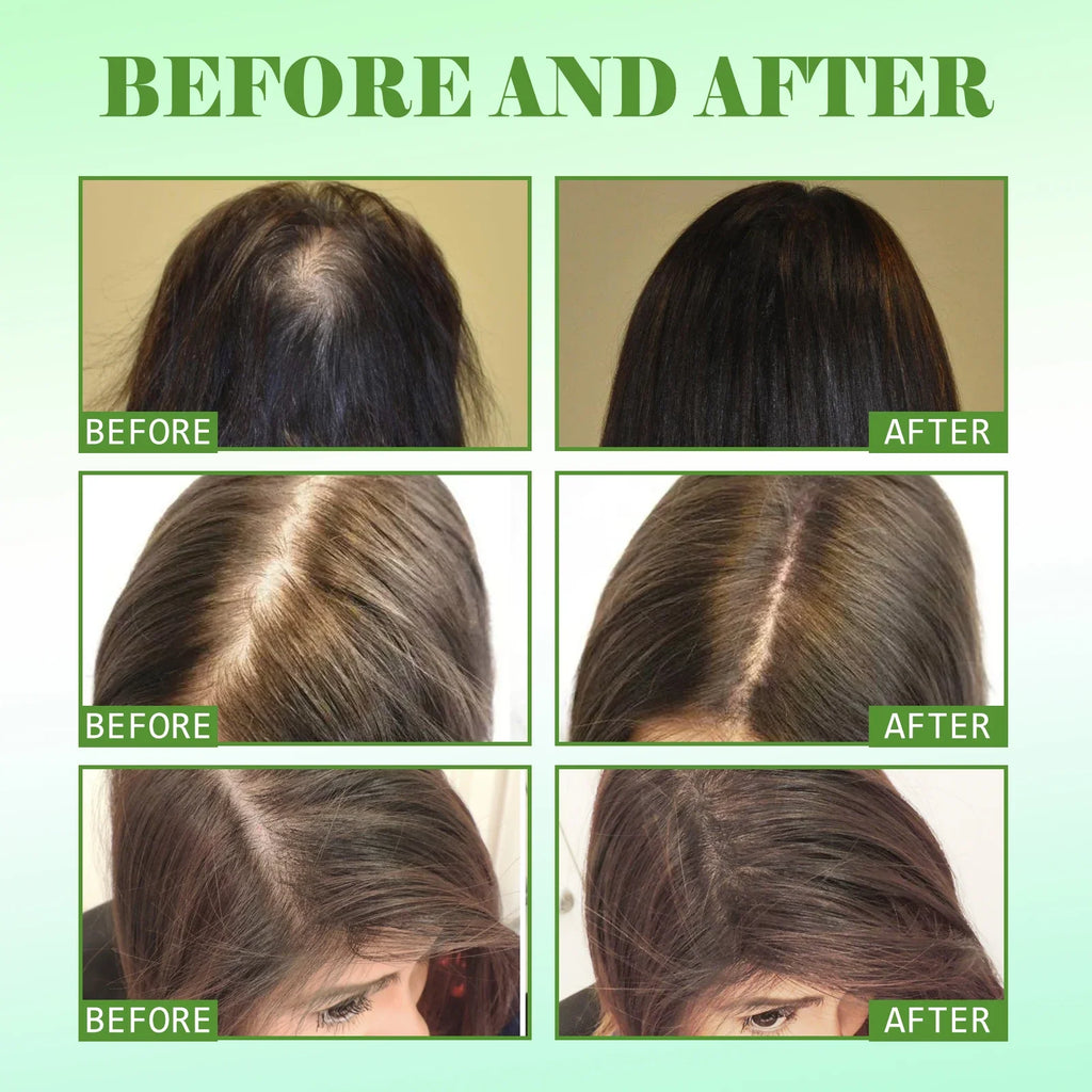 Premium Rosemary Hair Oil