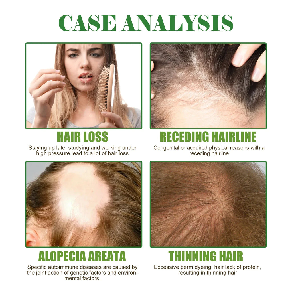 Premium Rosemary Hair Oil